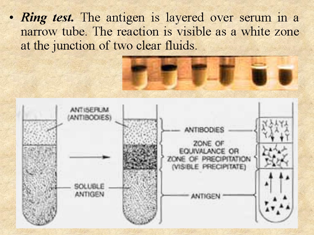 Ring test. The antigen is layered over serum in a narrow tube. The reaction